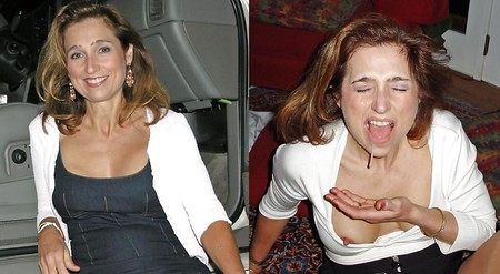 Before and After Facials 2