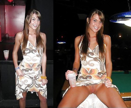 Before and After Teens Collection 1